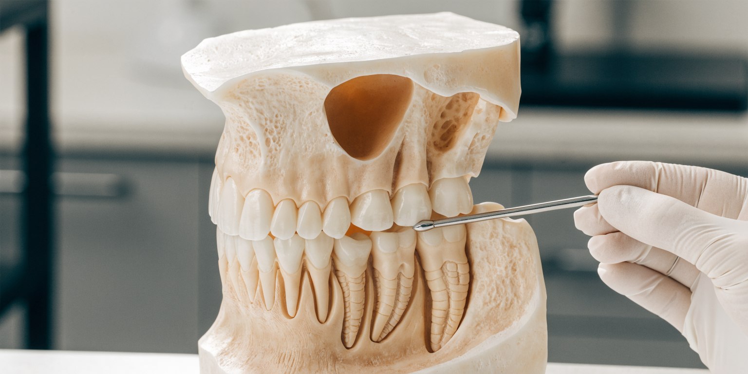 Educational model showing the upper back jaw, maxillary sinus, and dental implant site