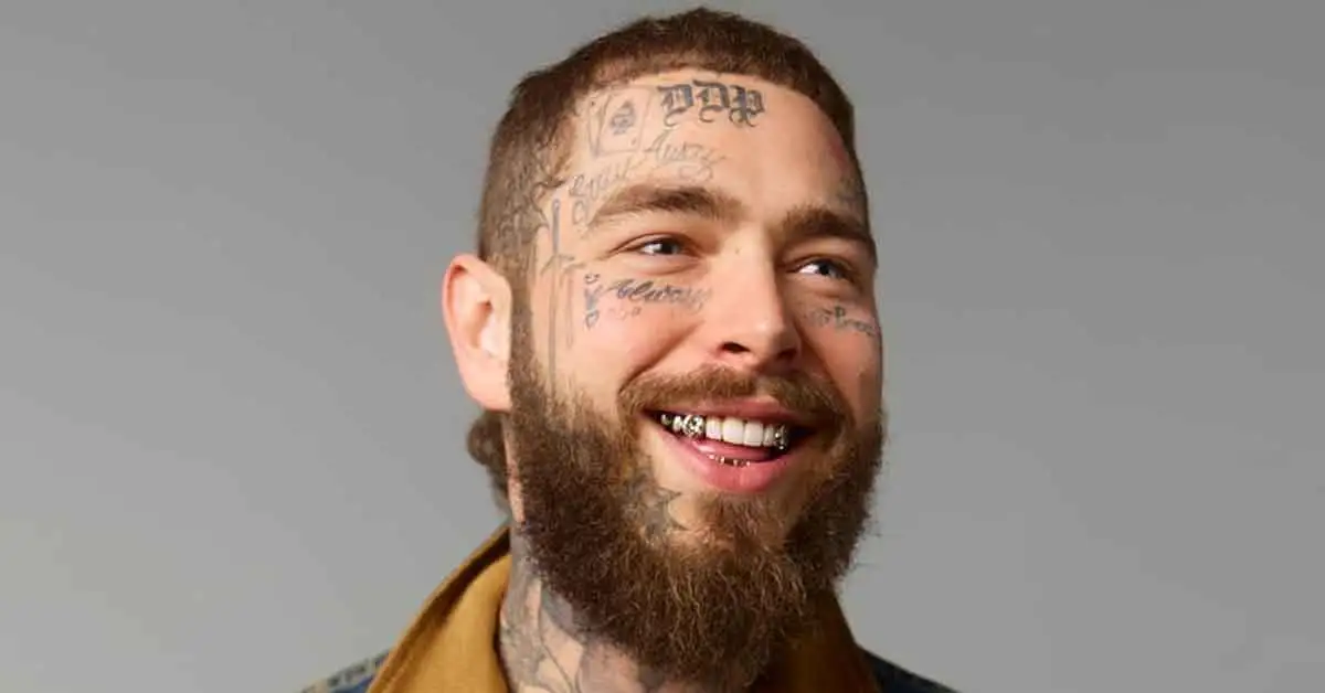 Post Malone's Teeth