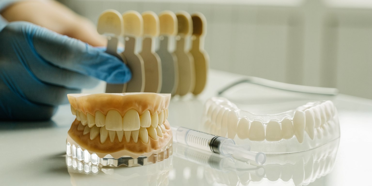 Custom whitening tray and shade tabs used during professional planning for tooth discoloration