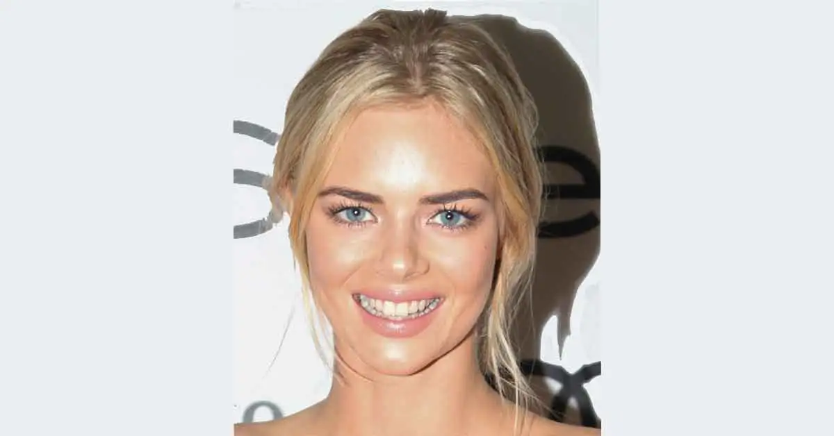 Samara Weaving's Teeth