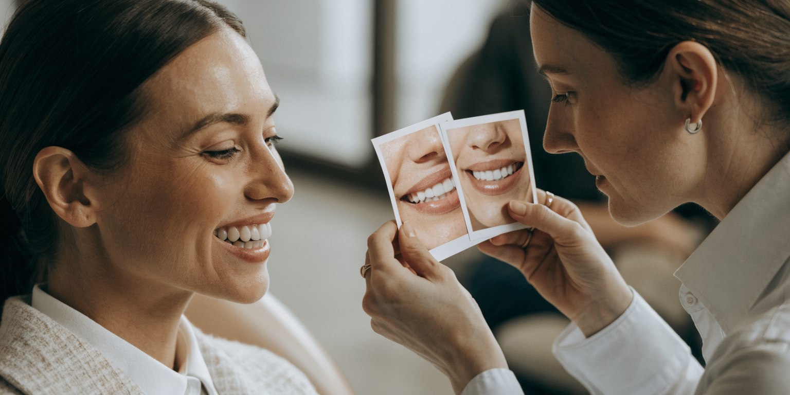 Smile line and smile width assessment for Hollywood Smile tooth-count planning