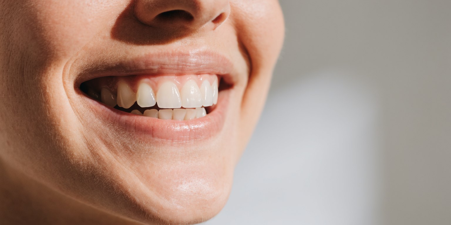 Natural broad smile showing front teeth and visible premolars in the smile zone