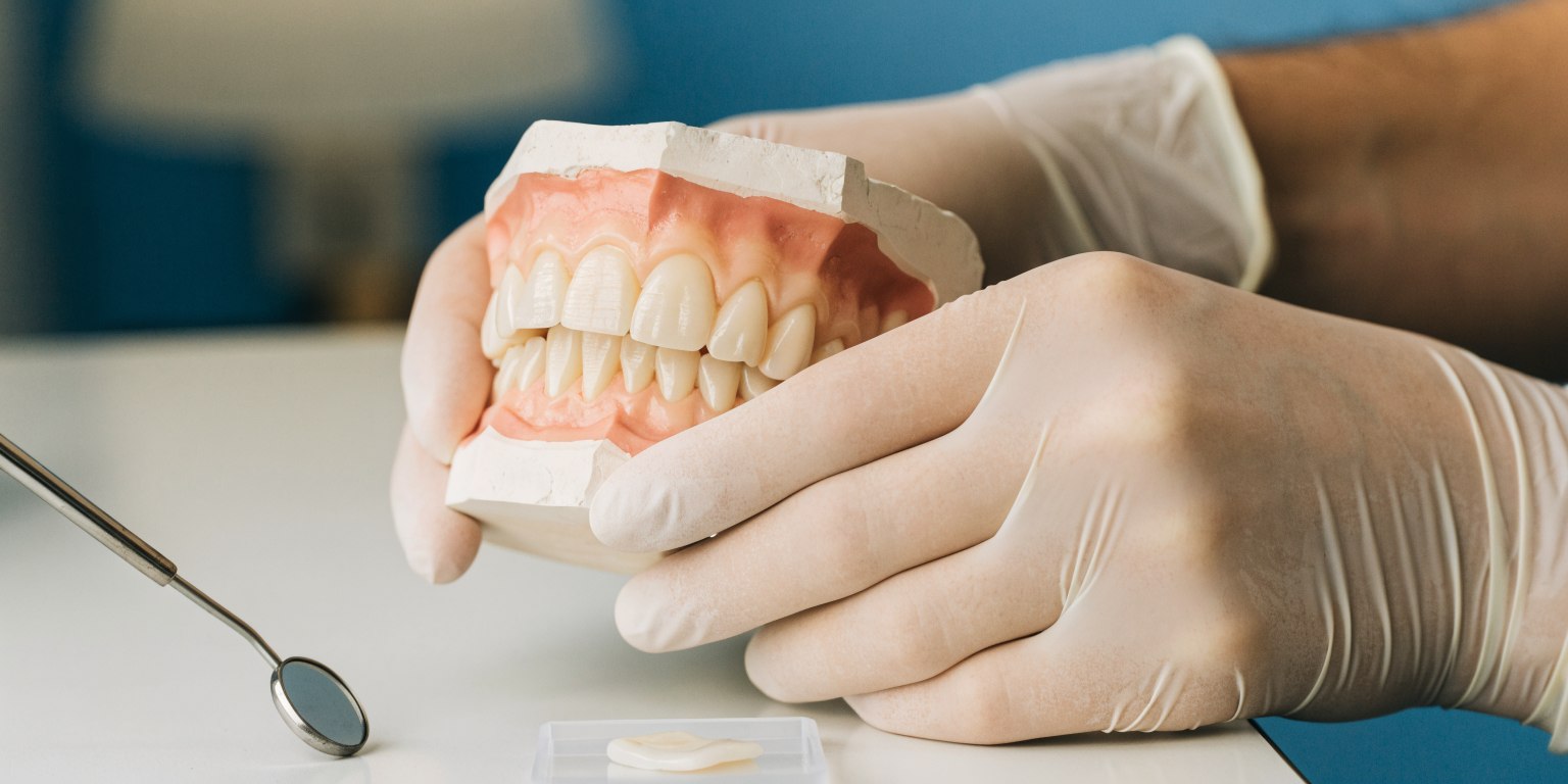Dentist using a dental model to explain a veneer assessment