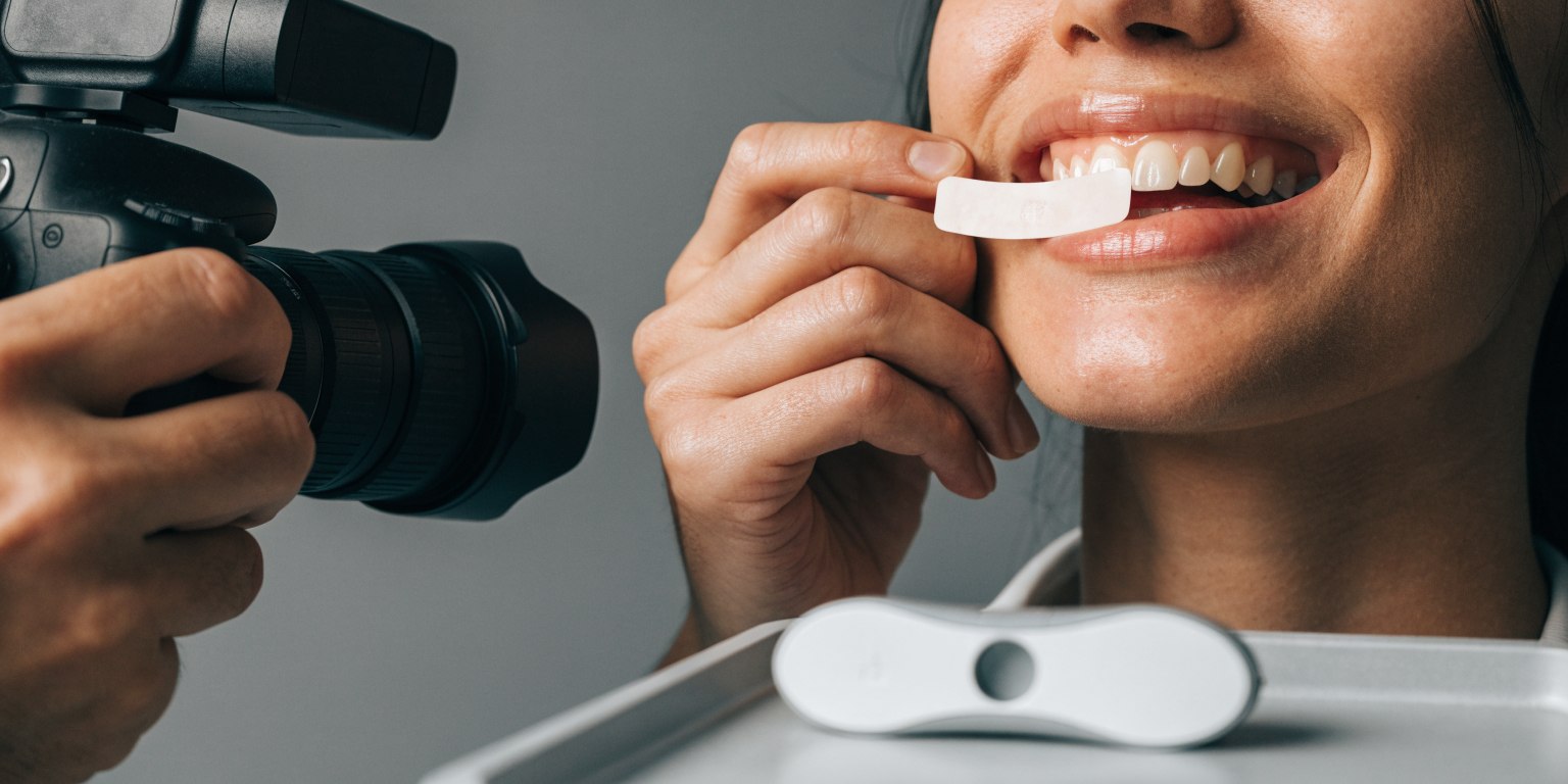 Dentist using photography and shade references to plan the color of a ceramic veneer