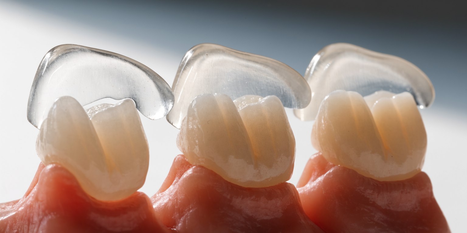 Ceramic veneer samples with different thickness and translucency levels beside realistic tooth models