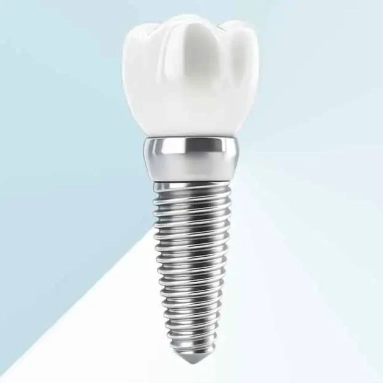BEGO-Dental-implants