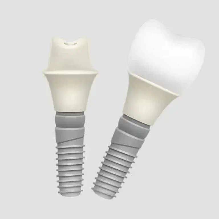 Dentsply Sirona Dental Implants