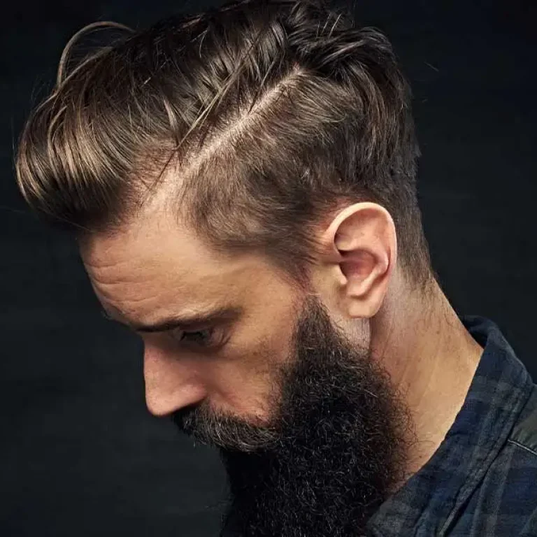 hair-transplant image