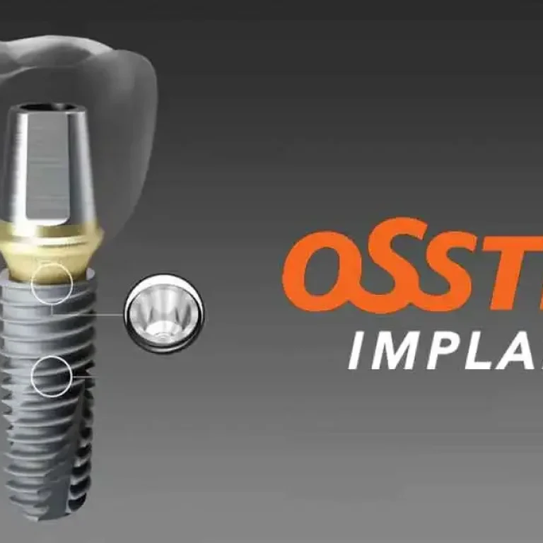 Osstem dental implant consultation at Niva Aesthetic