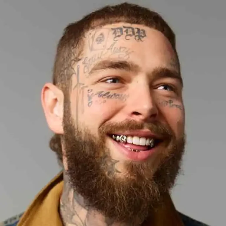 Post Malone's Teeth